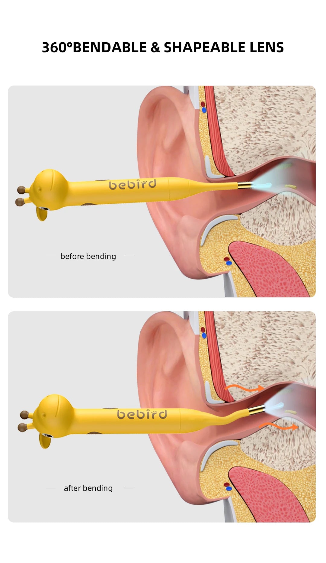 Bebird D3 Pro Kids Visual Otoscope Earwax Cleaner – Safe, Smart, and Easy-to-Use Ear Care!