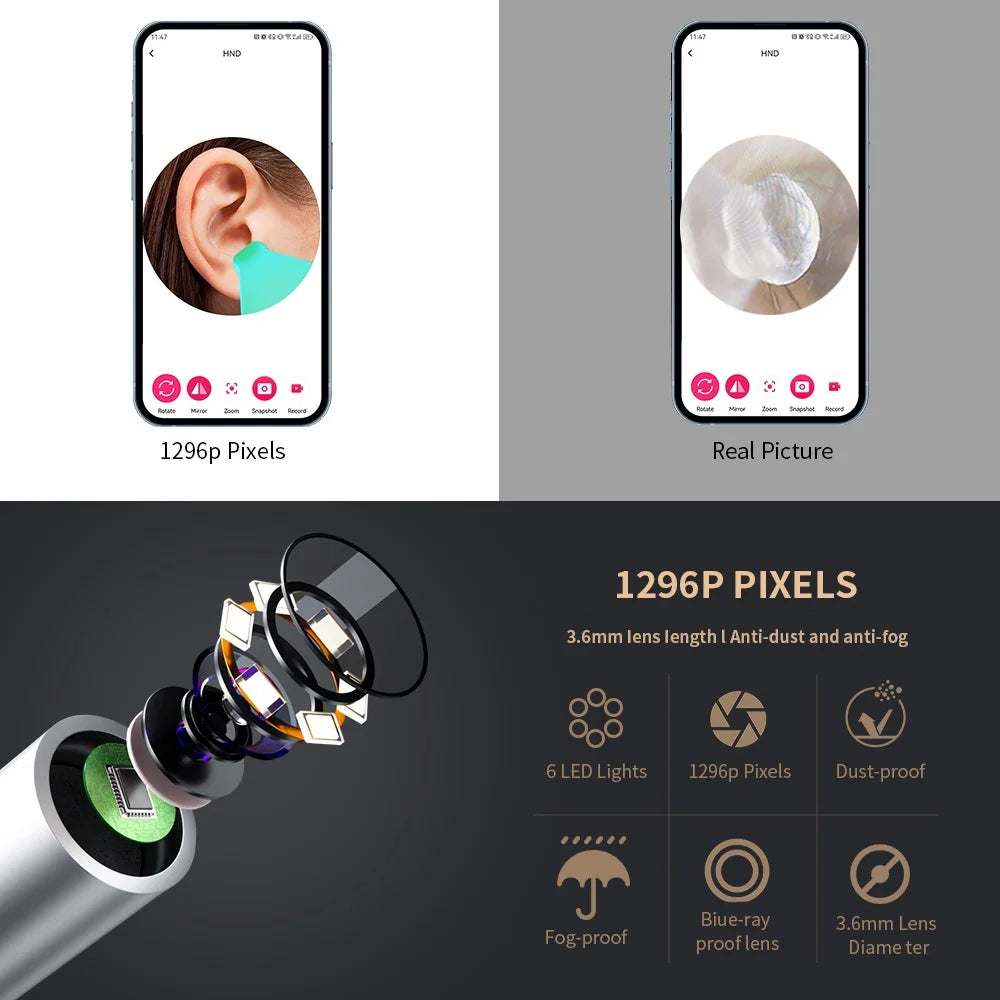 Smart Visual Ear Cleaner with Camera – Safe, Clear, and Precise Ear Care!