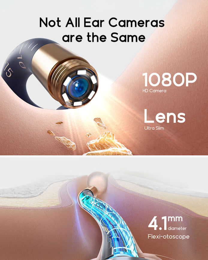 Bebird EarSight Plus I35R/R37R/D39R Visual Earpick Kit 2025 – The Ultimate All-in-One Ear Care Solution!