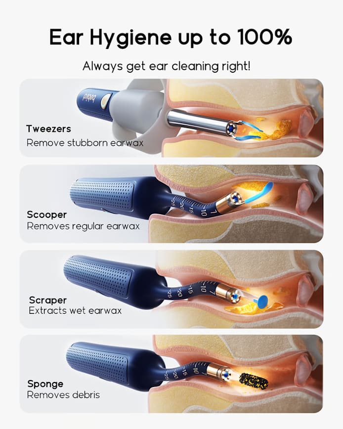 Bebird EarSight Plus I35R/R37R/D39R Visual Earpick Kit 2025 – The Ultimate All-in-One Ear Care Solution!