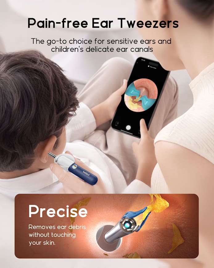 Bebird EarSight Plus I35R/R37R/D39R Visual Earpick Kit 2025 – The Ultimate All-in-One Ear Care Solution!